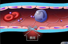 醫學動畫 醫學動畫